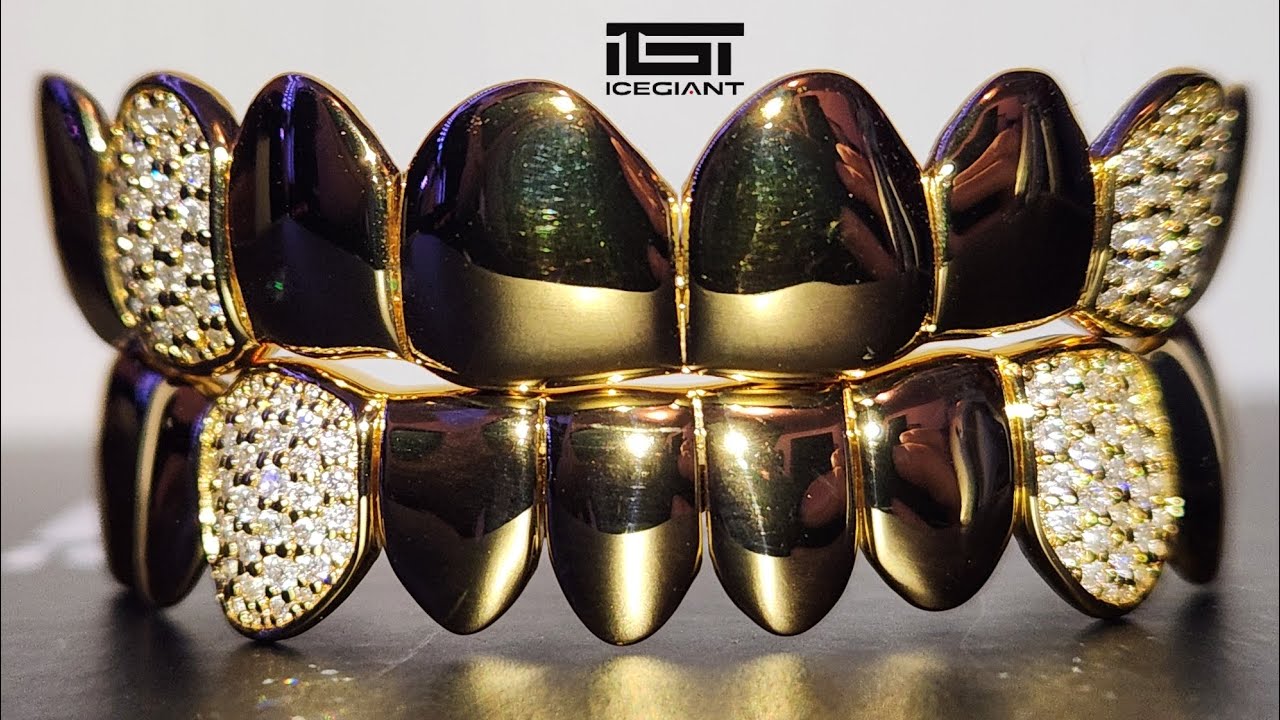 UNBOXING MOISSANITE GRILLZ FROM ICEGIANT!