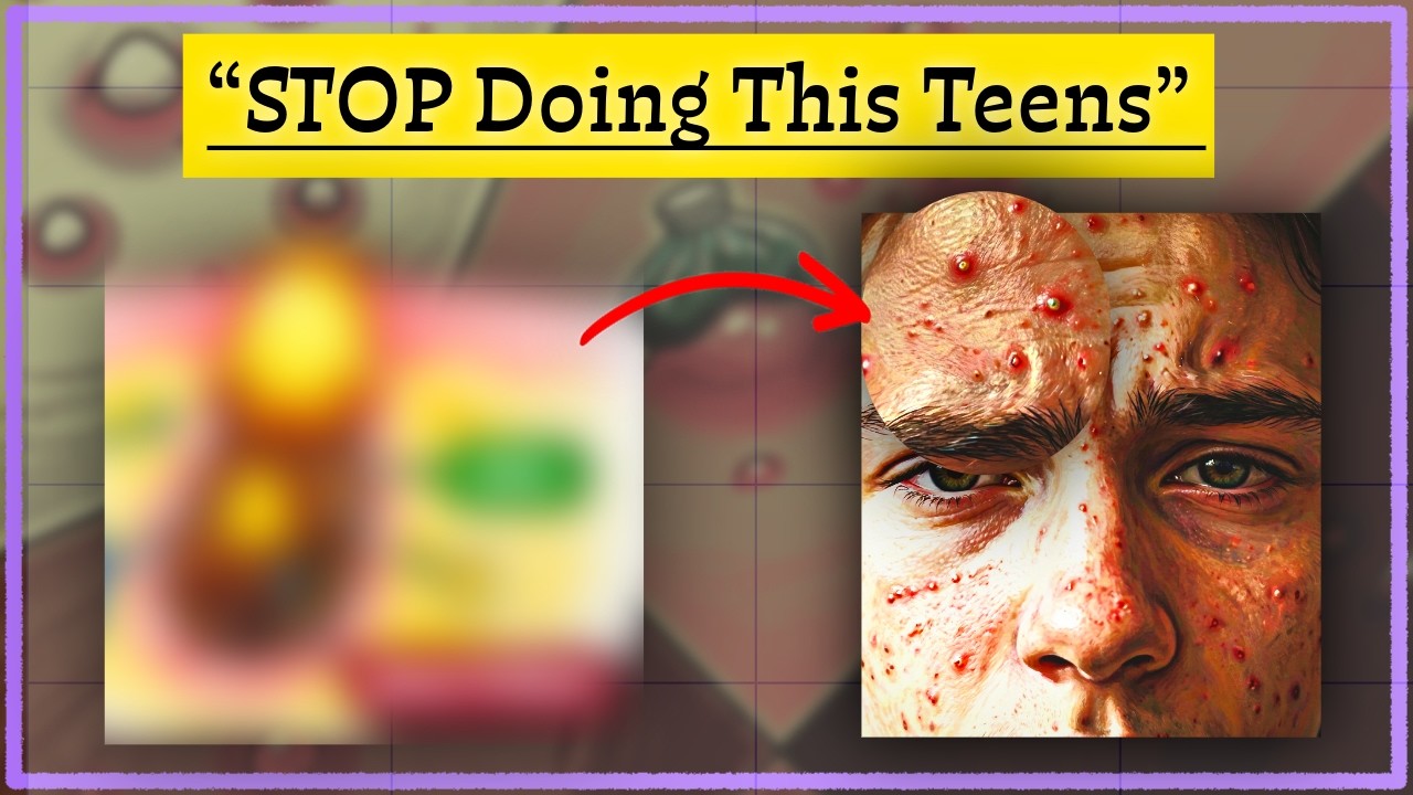 Top 10 Acne Mistakes Teenagers Make