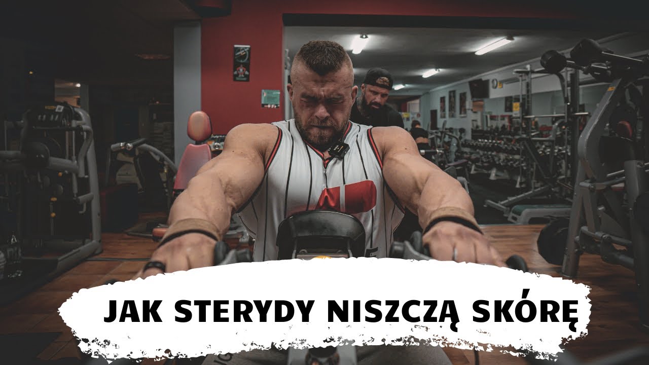 Jak sterydy niszczą skórę (zła dieta + higiena)