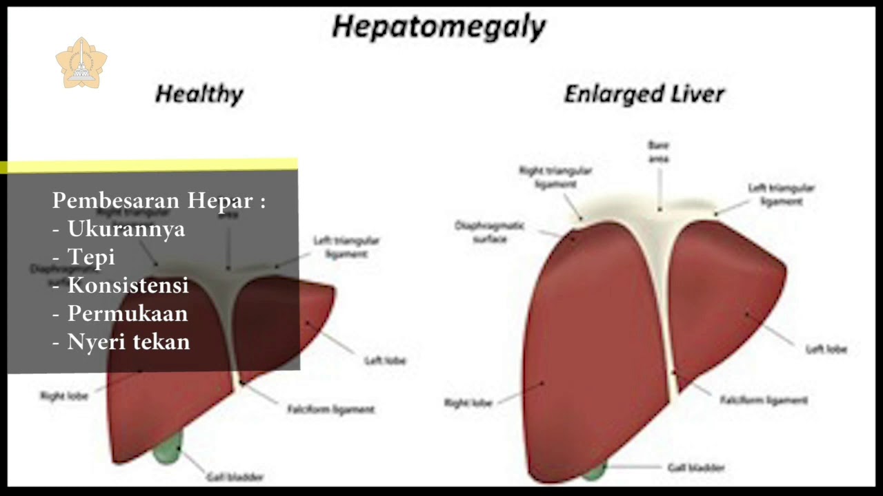 Pemeriksaan Fisik Sistem Hepatobilier - dr. Desi Maghfirah, Sp. PD