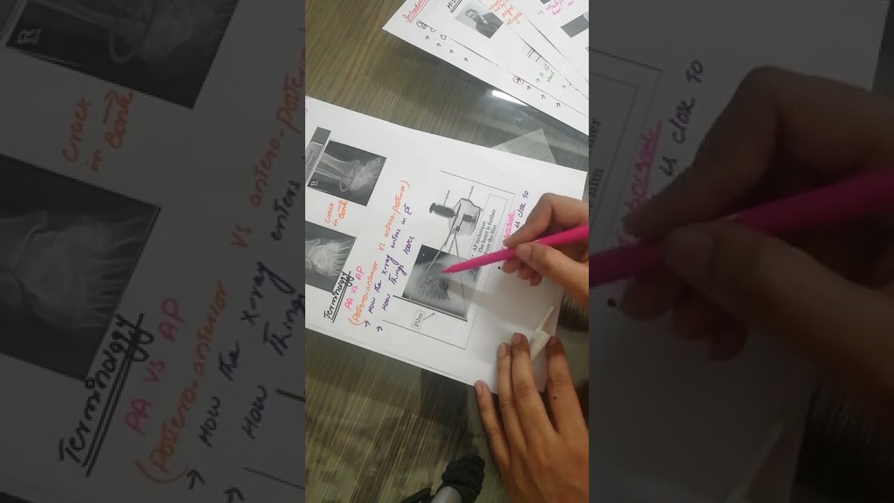 Conventional Radiography || X-Rays || Radiology