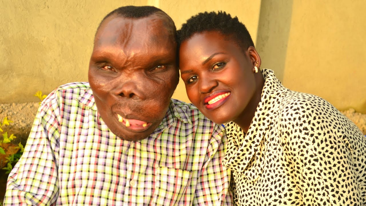 This Couple Shocked The World | Ugliest Man Sebabi Marries Another Wife | Born Different