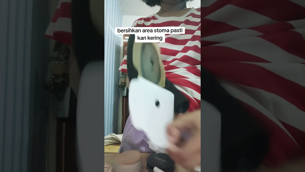 kantong stoma bocor saat tidur #ostomy #ostomybag #ostomate #kankerusus #viral