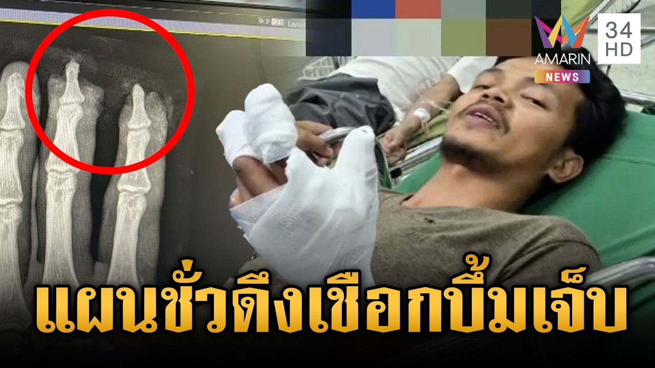ทหารลาดตระเวนดึงเชือกปริศนาซุกใต้ใบไม้ ระเบิดเจ็บ 1 นาย | ข่าวเย็นอมรินทร์ | 24 ก.พ. 69