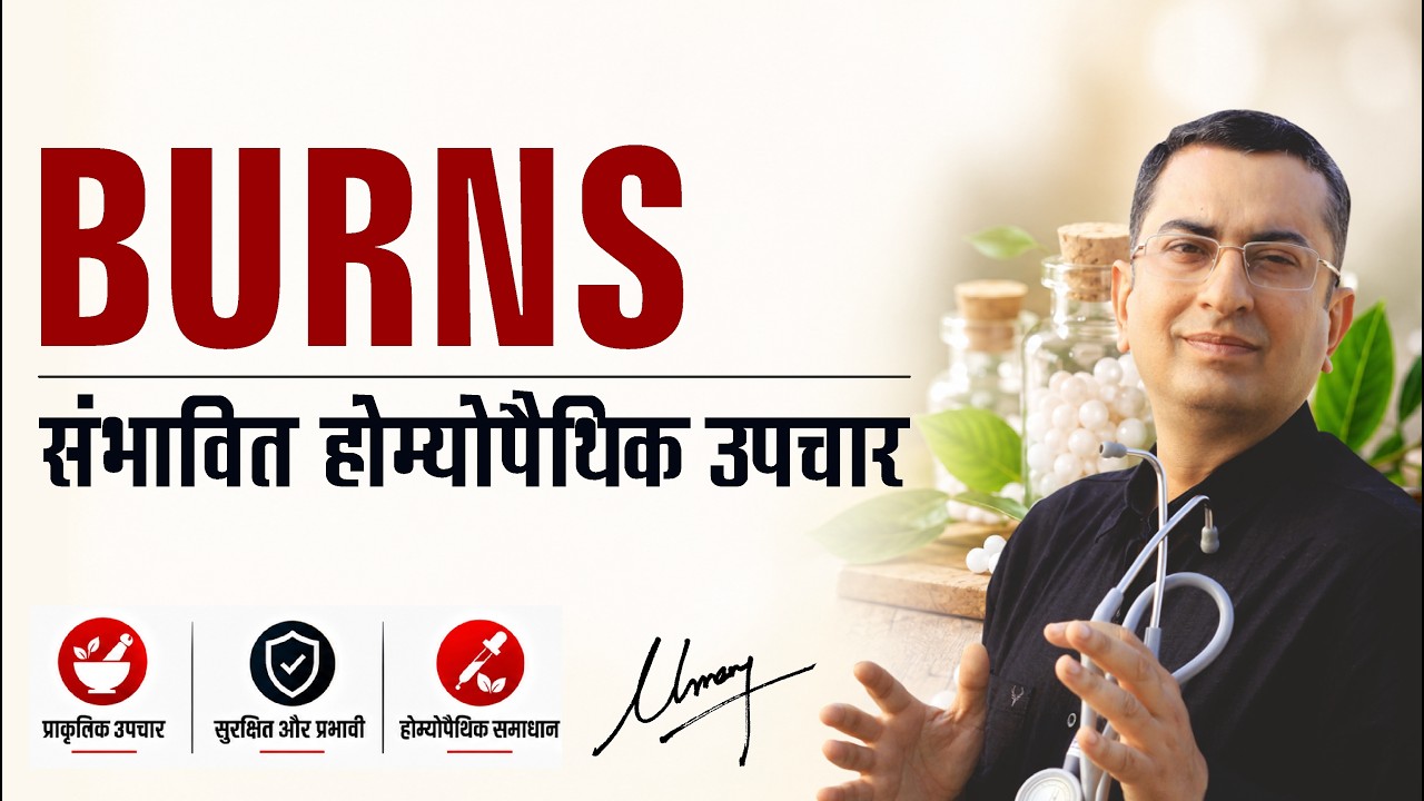 जलने / बर्न || Burn Injury || Natural Homeopathic remedies with symptoms || होम्योपैथिक उपचार