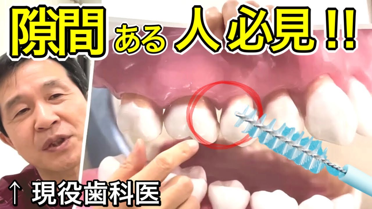 【歯間ブラシ 】使用禁忌の人も… 歯医者が教える安全で効果的な使い方