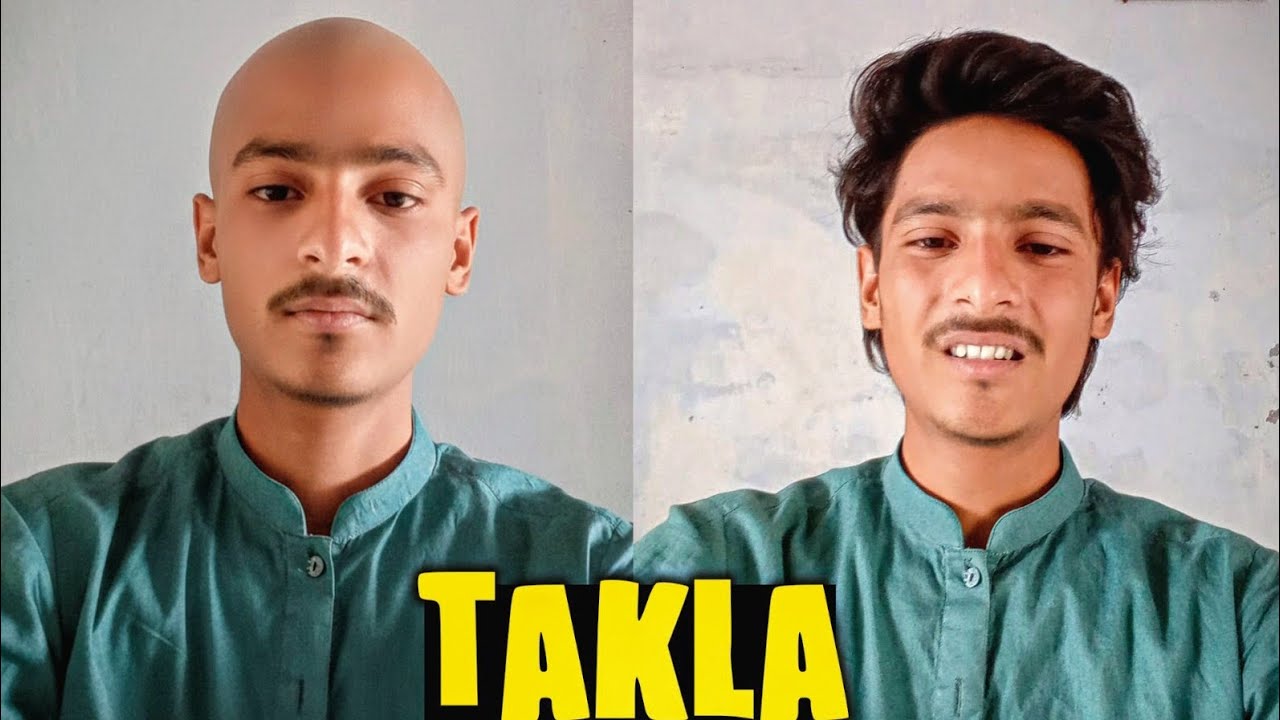 Soch Raha hon Takla Ho Jaao 😂 Ho Jao Ya Nae ap Batao 
