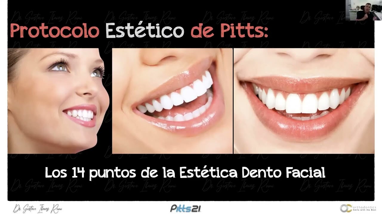Sistema Pitts 21 | La Última Tecnología en Ortodoncia