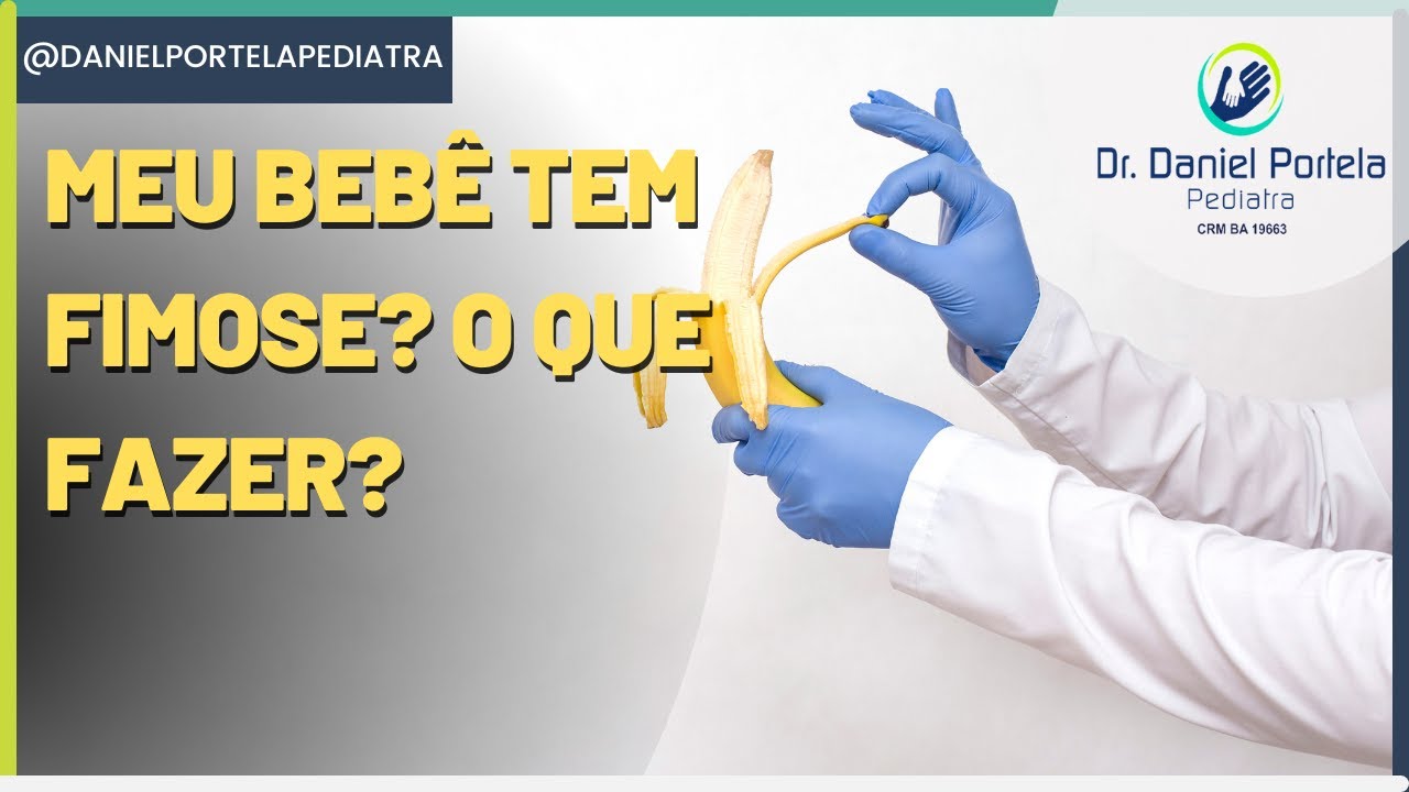 Meu beb&ecirc; tem fimose? O que fazer?