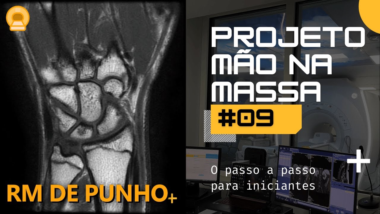 Mão Na Massa 09 | Planejando um punho
