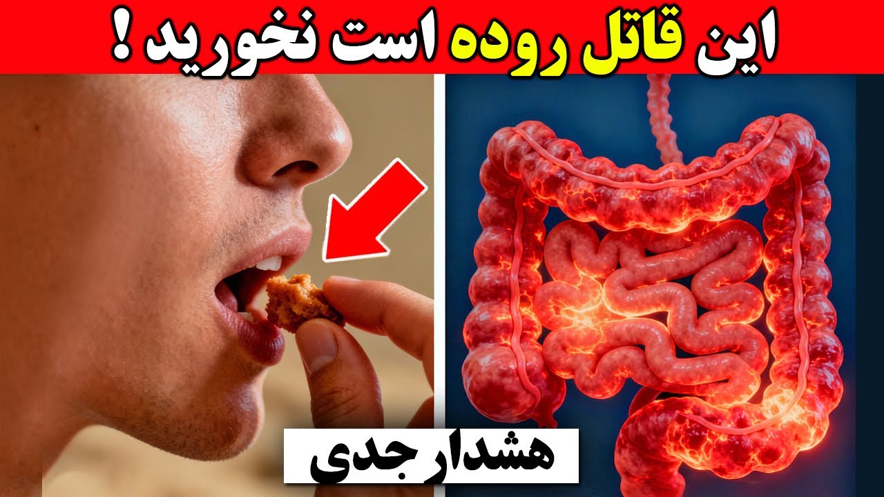 اخطار❌ این ۷ ماده غذایی روده های شما را از بین میبرن دشمن اصلی روده ها که هر روز می خوریم