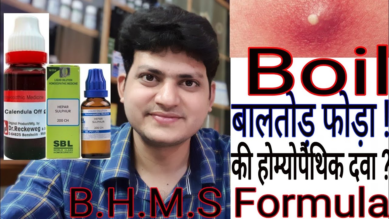 बालतोड़ ! फोड़ा ! Boil ! Homeopathic medicine for Boils ?? B.H.M.S FORMULA !