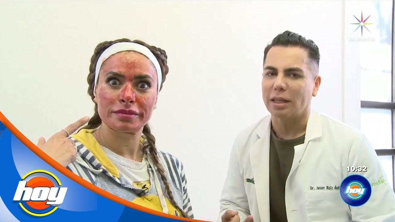 Galilea Montijo se somete a tratamiento de rejuvenecimiento | Hoy