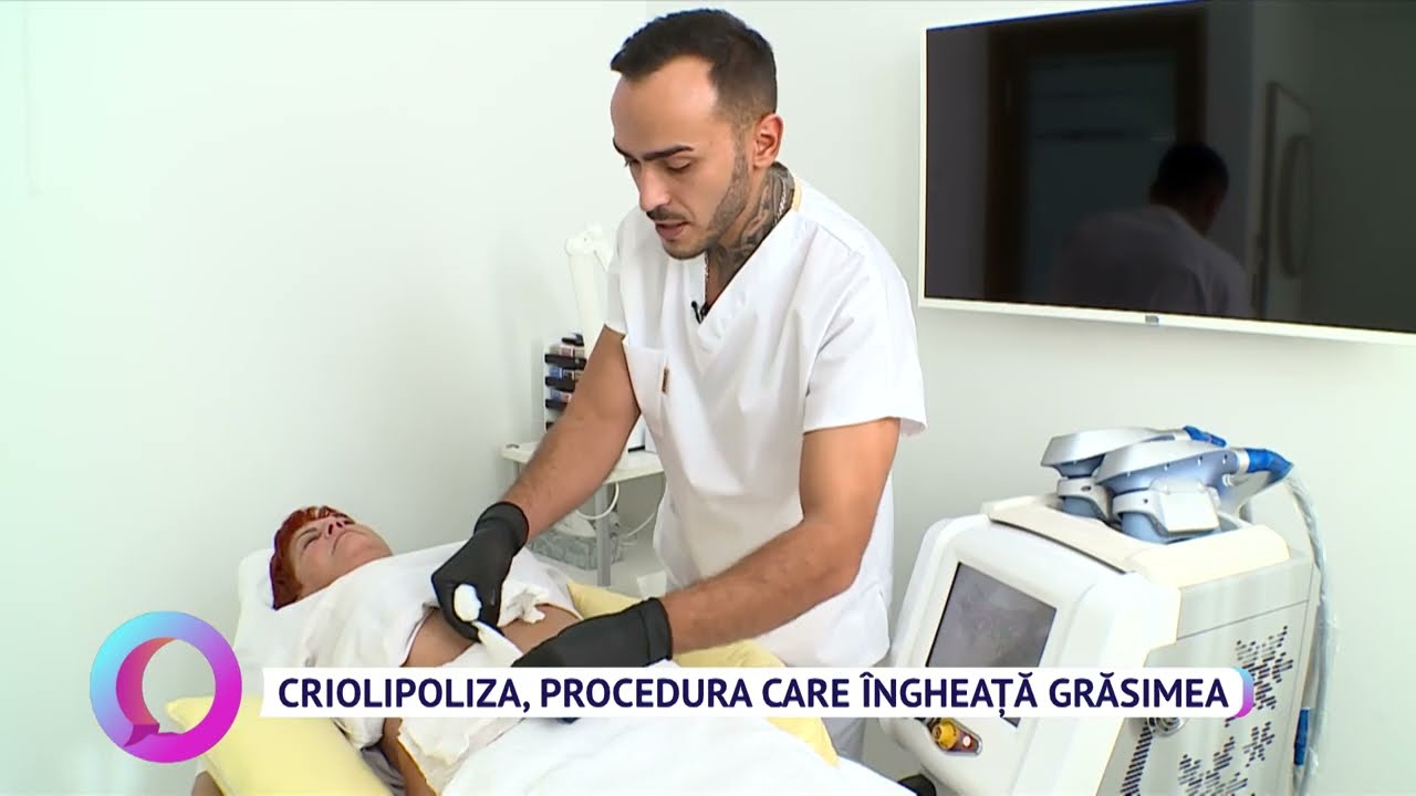Criolipoliza, procedura care îngheață grăsimea