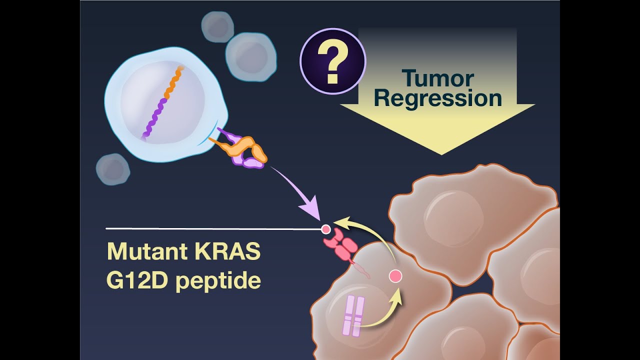 TCR Gene Therapy in Pancreatic Cancer | NEJM