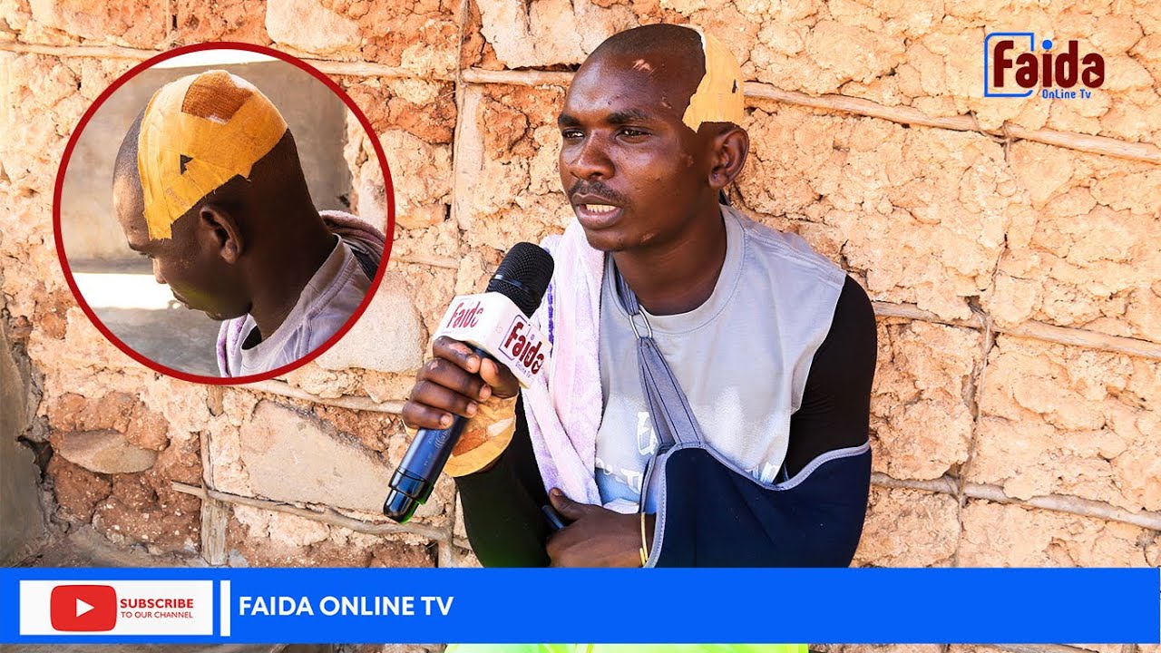 ALIYEMCHOMA KISU BODABODA ILI KUMPORA PIKIPIKI MTWARA AVUNJA MGUU PAPOHAPO