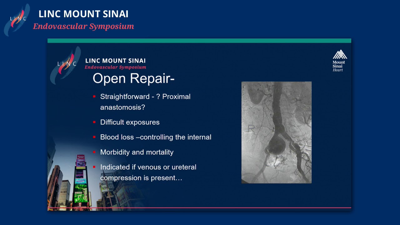 Isolated Iliac Artery Aneurysms: Treatment Options