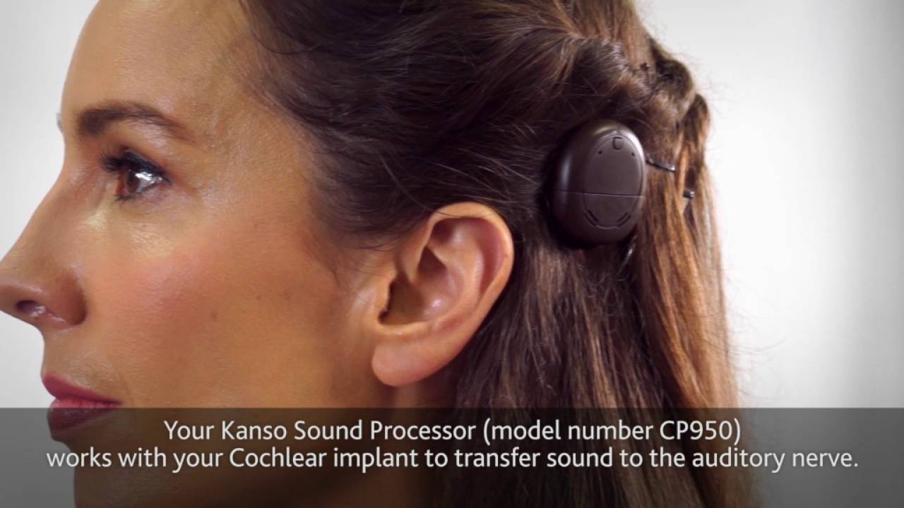 About the Cochlear&trade; Kanso&trade; Sound Processor