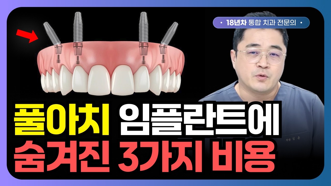 풀아치 임플란트에 숨겨진 3가지 비용, 가격이 너무 비싸다면 이걸 확인하세요