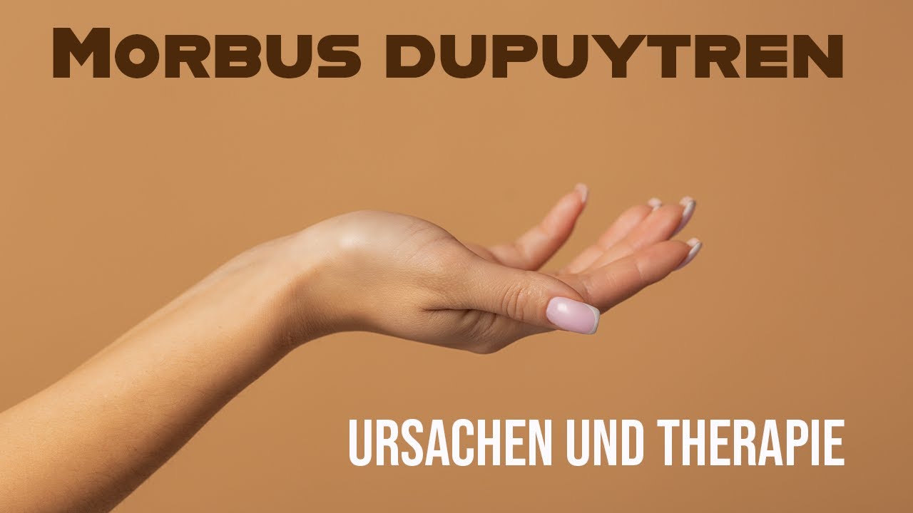 Morbus dupuytren – Mögliche Ursachen und Therapie