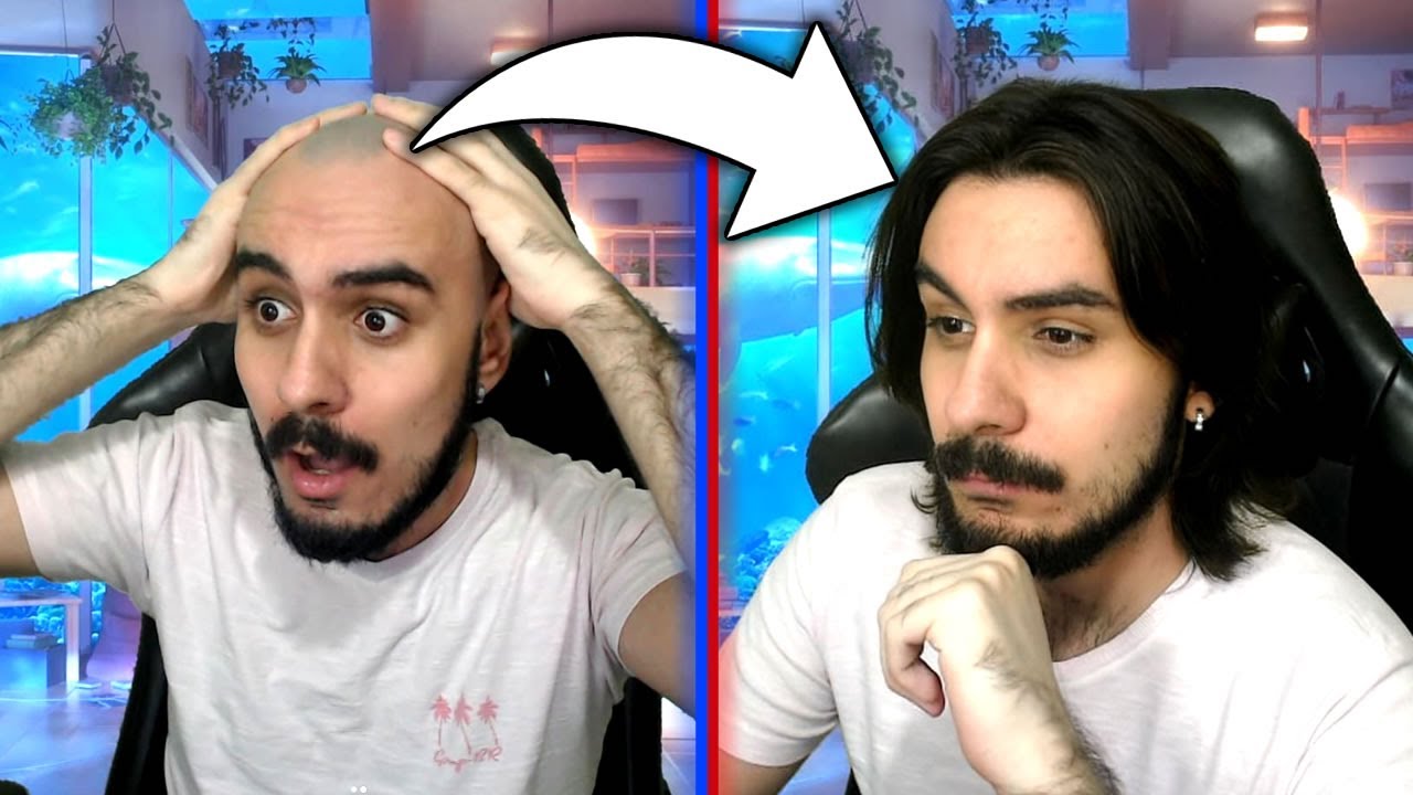 Fir3z deixou de ser CARECA!!!!!! 🤣🤣🤣 [reupload]