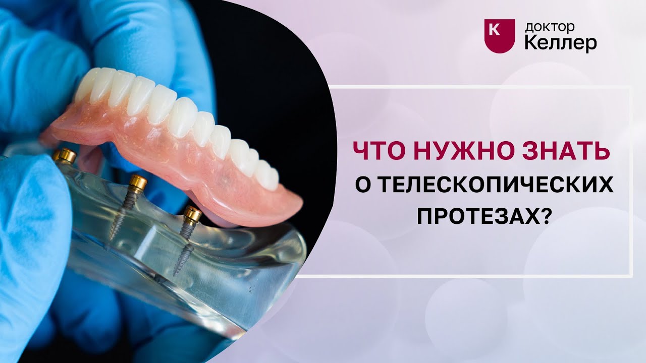 Что нужно знать о телескопических протезах?