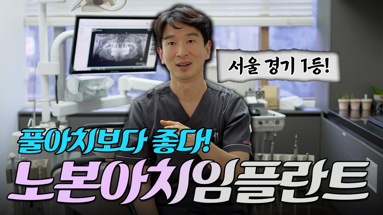 노본아치의 등장 #풀아치 업그레이드버전 #모르면손해