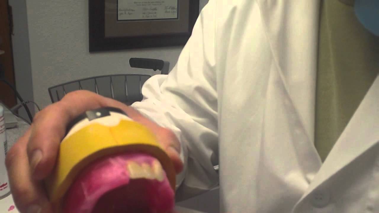 How to Set Maxillary Anterior Denture Teeth - Lingualized Non Balanced Occlusion