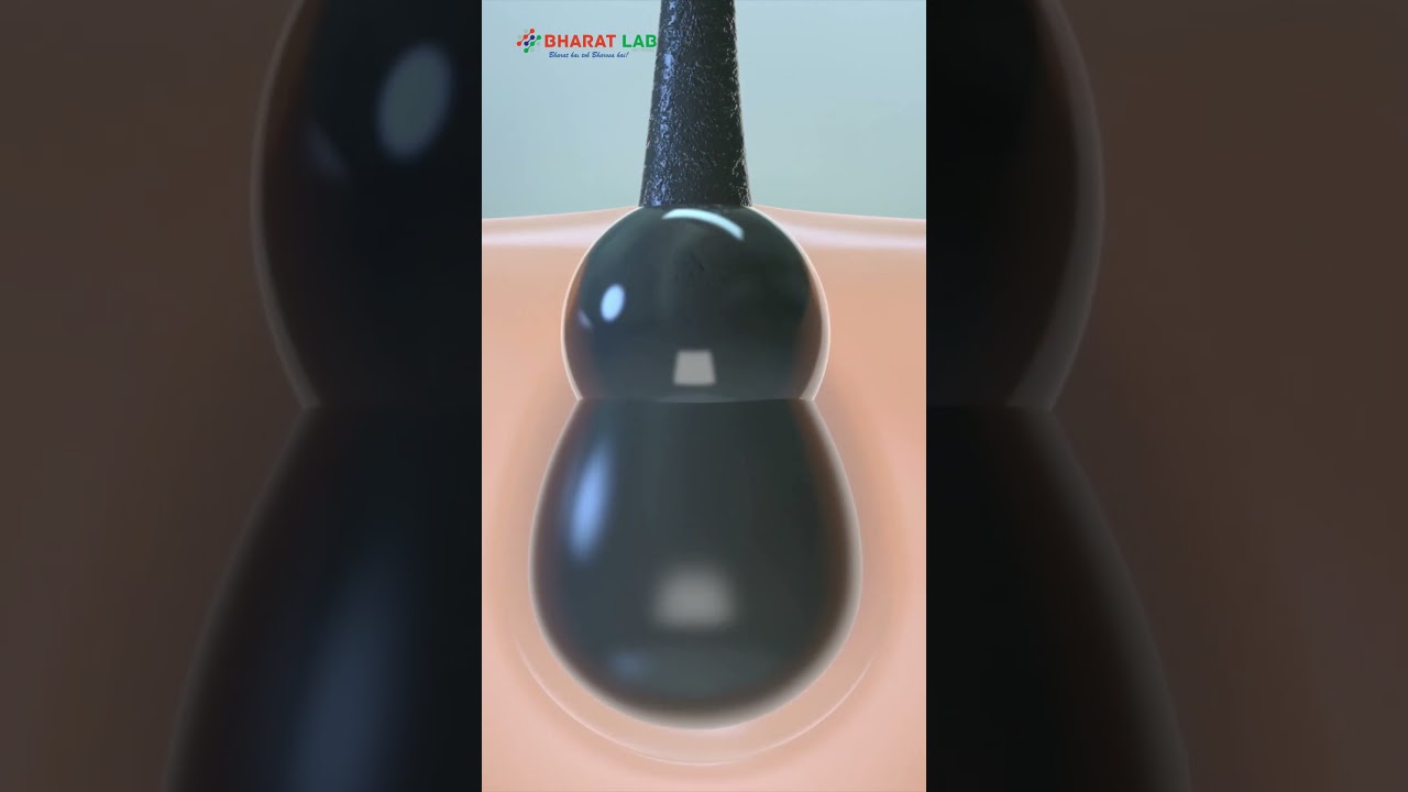 Hair fall sirf oil se nahi rukta! | Hair Problems | 