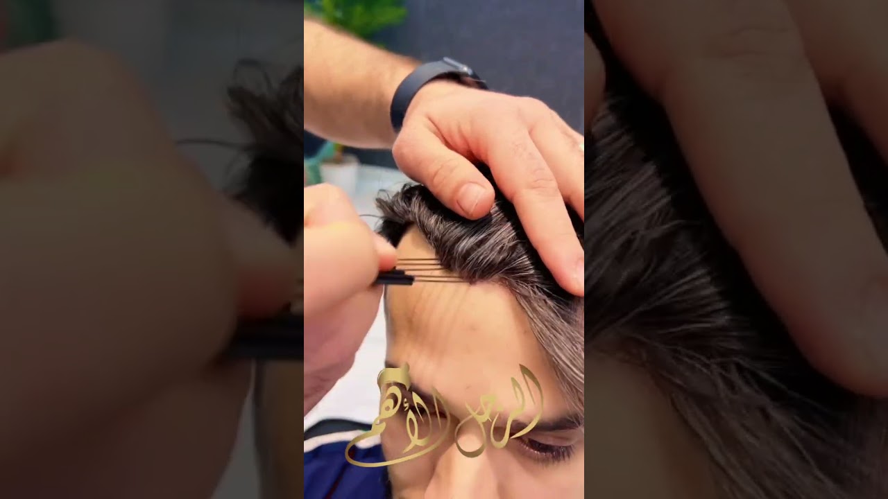 تركيب شعر طبيعي للرجال ( الرياض) #ترند #تركيب_شعر #باروكه #تركيب_شعر_طبيعي #يونت #باركات_الرياض