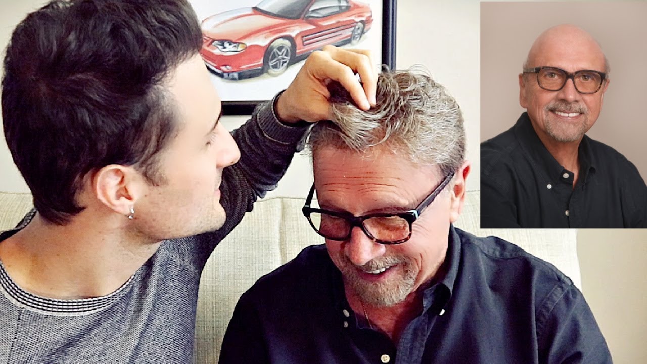Evolution of Hair Replacement Systems (1969 - 2019)