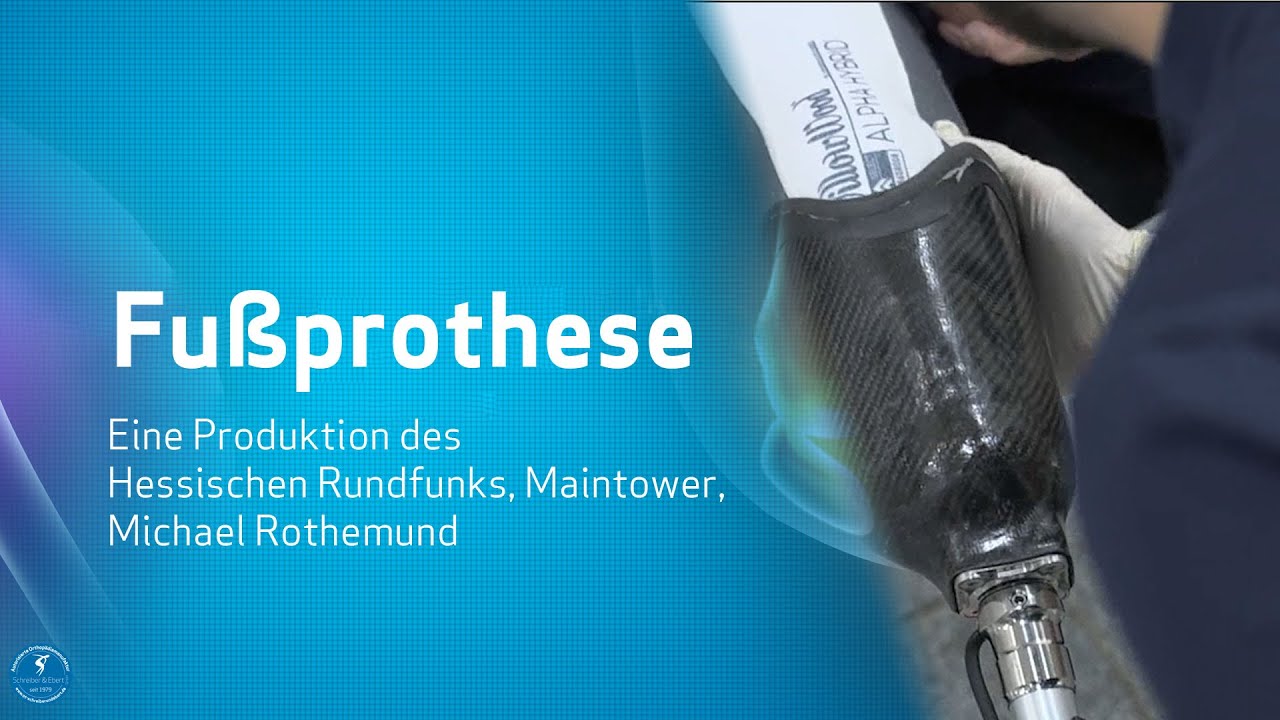 Werner Heiler bekommt eine Fußprothese