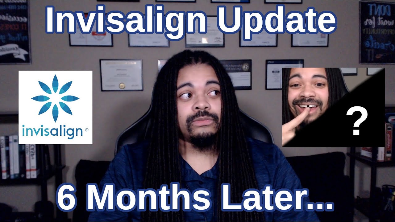 Invisalign Update - 6 months later (w/ pictures)