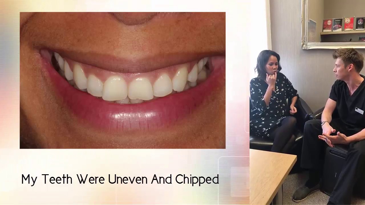 Jean Johansson transforms her smile and her confidence at Dentistry on the Square