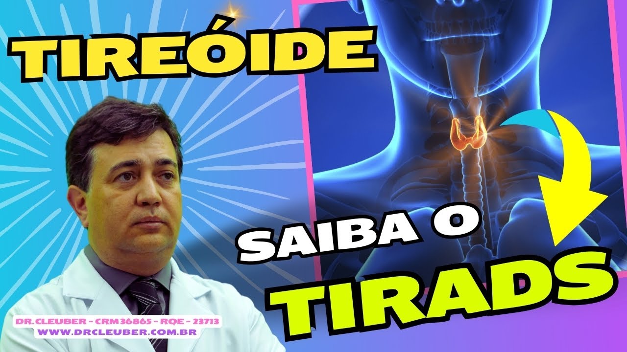 🦋 Nódulo de Tireóide, Tirads e Câncer. Características e o que Significa.