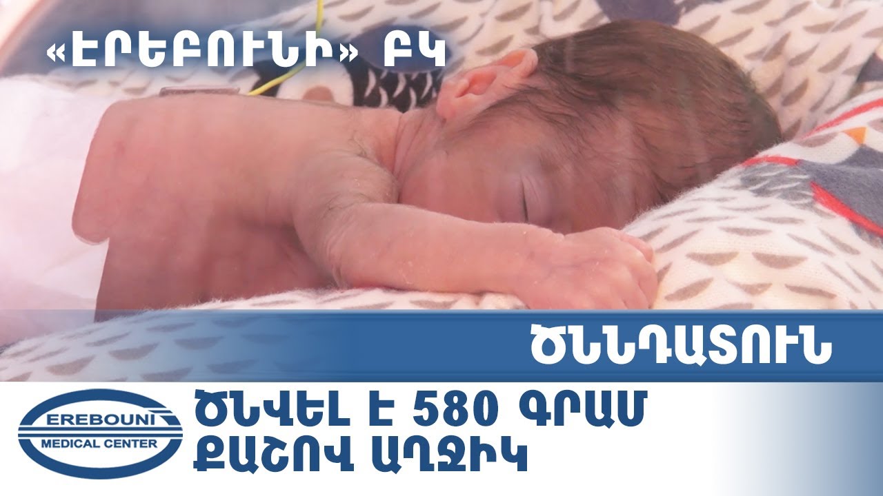 &laquo;Էրեբունի&raquo; ԲԿ ծննդատանը ծնվել է 580 գրամ քաշով աղջիկ