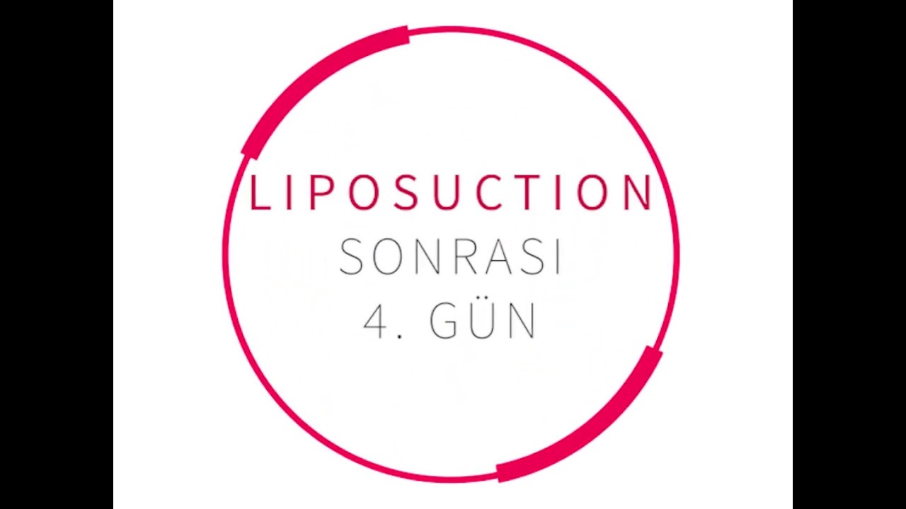 Liposuction Sonrası 4. G&uuml;n