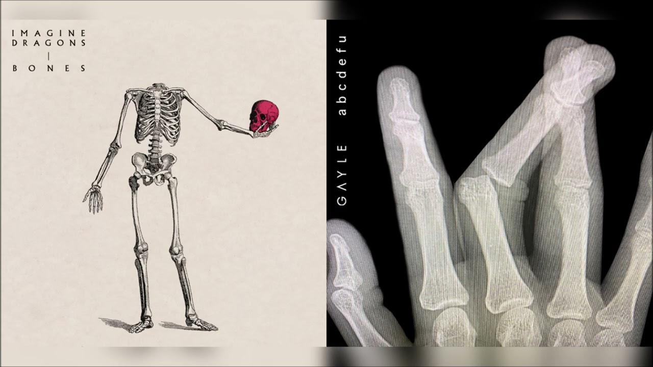 Bones x abcdefu (mashup) - Imagine Dragons + GAYLE