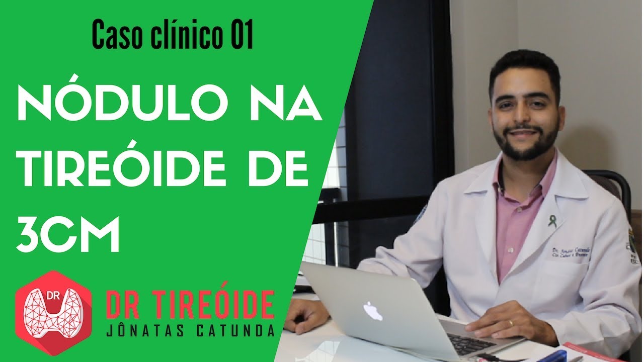 Nódulo na tireóide de 3cm - Caso clínico #01# | Dr Jônatas Catunda