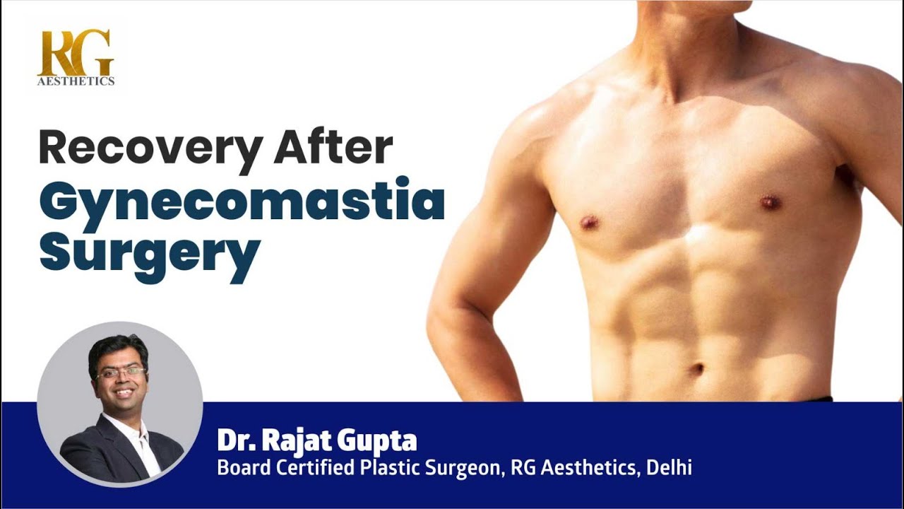Recovery after Gynecomastia Surgery | Gynecomastia Treatment in Hindi | Dr Rajat Gupta, Delhi