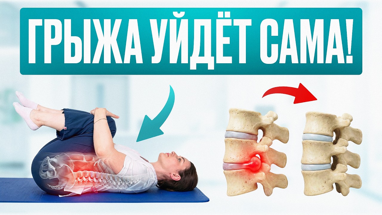 Безопасные упражнения при грыже в пояснице, которые помогают организму справляться самостоятельно!