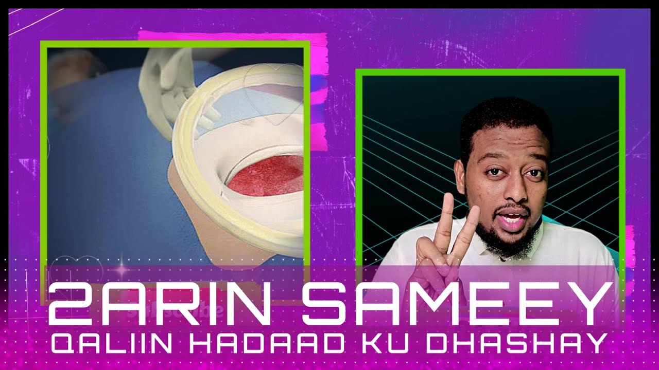 2 ARIN SAMEY QALIIN HADAAD KU DHASHAY | #somalia #dumar #caafimaad #QALIIN #DHALMO #DHALMADA #birth