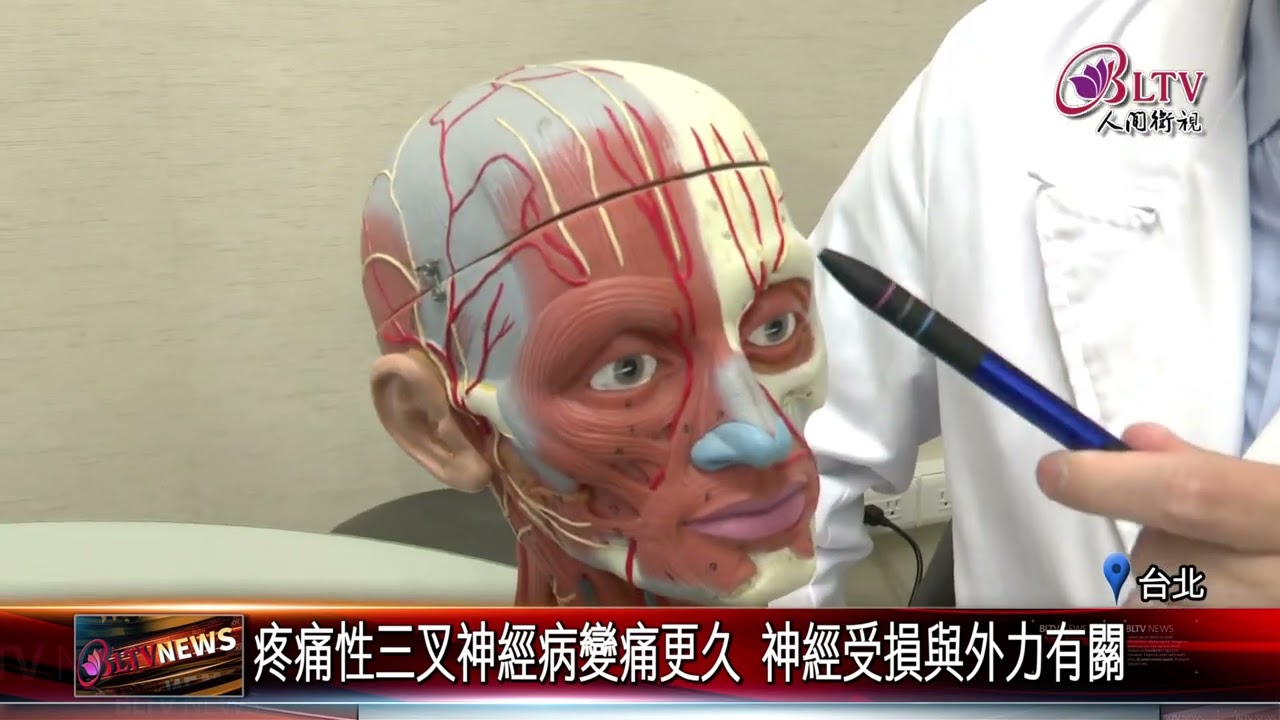 20260318臉頰莫名疼痛牙科檢查沒問題 恐是三叉神經病變｜@FGSBLTV
