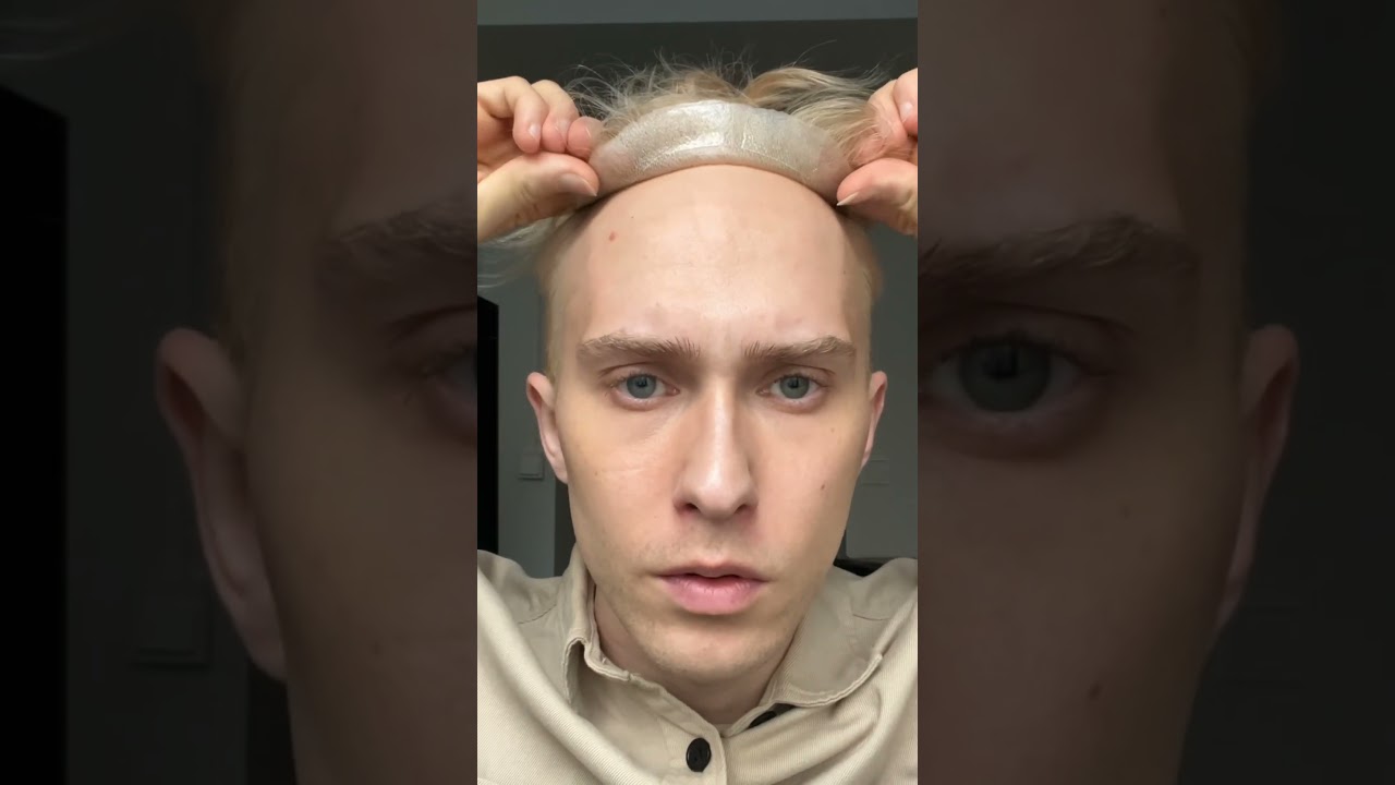 😎Transform My Look with Easy Hair System Installation #hair #hairsystem #hairloss #shorts