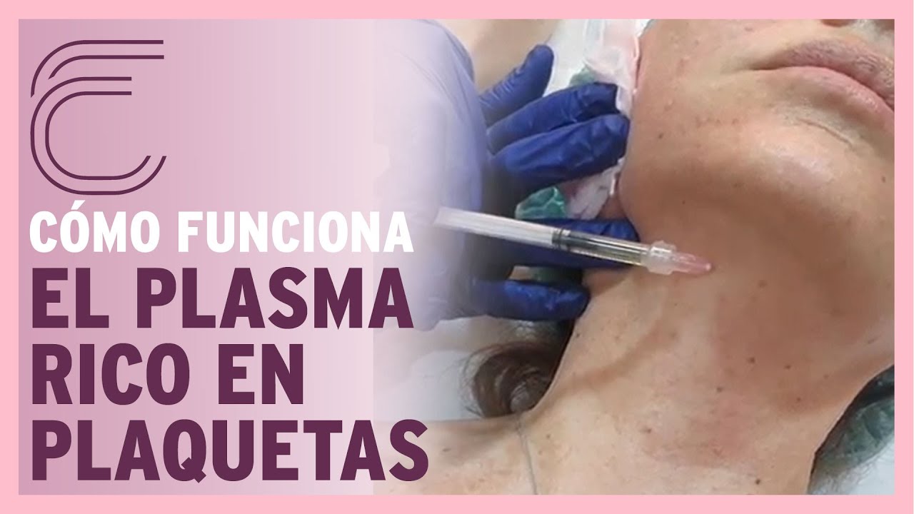Cómo funciona el PRP - PLASMA RICO EN PLAQUETAS para la piel y el cuero cabelludo