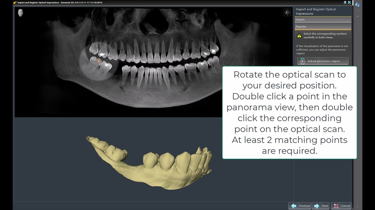 Sicat Implant: Prepare Data – Optical Impression