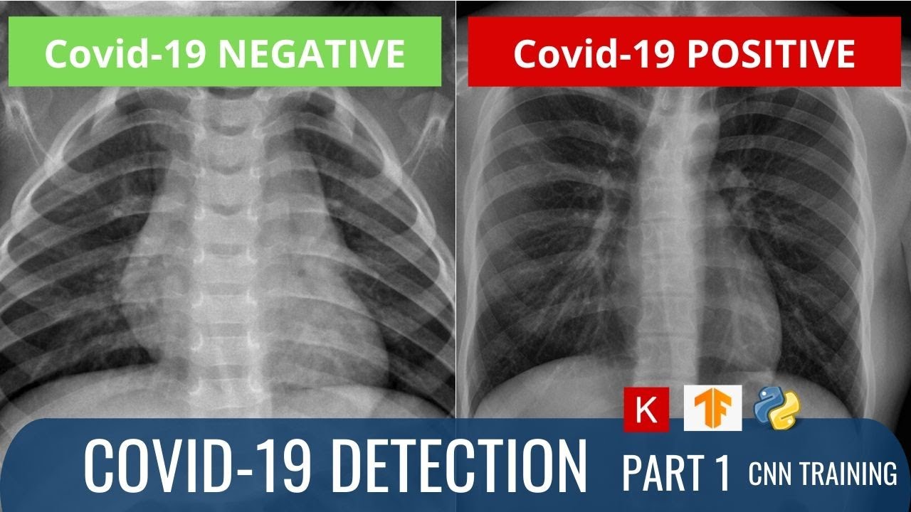 Covid-19 Detection using X-Ray Images - Part 1 (Convolutional Neural Network training)