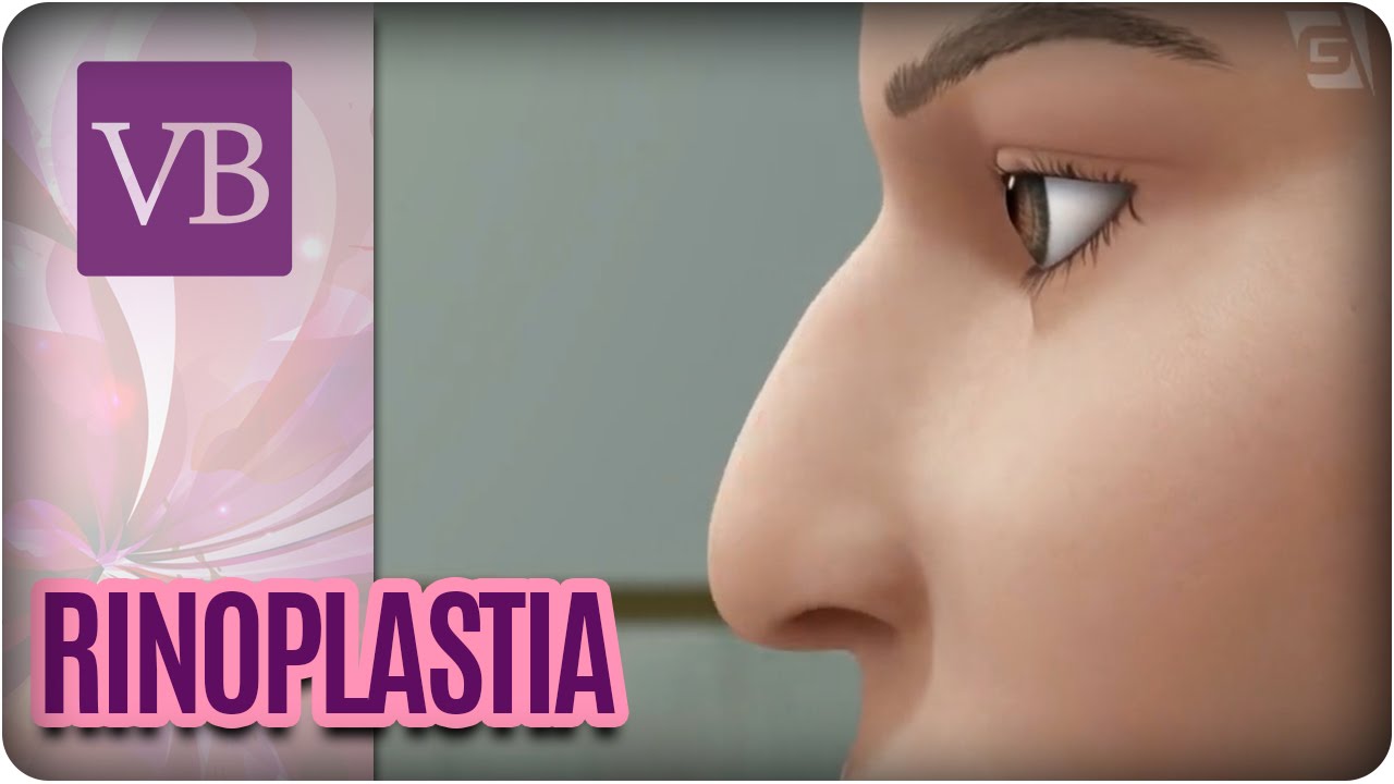 Rinoplastia - Você Bonita (12/09/16)