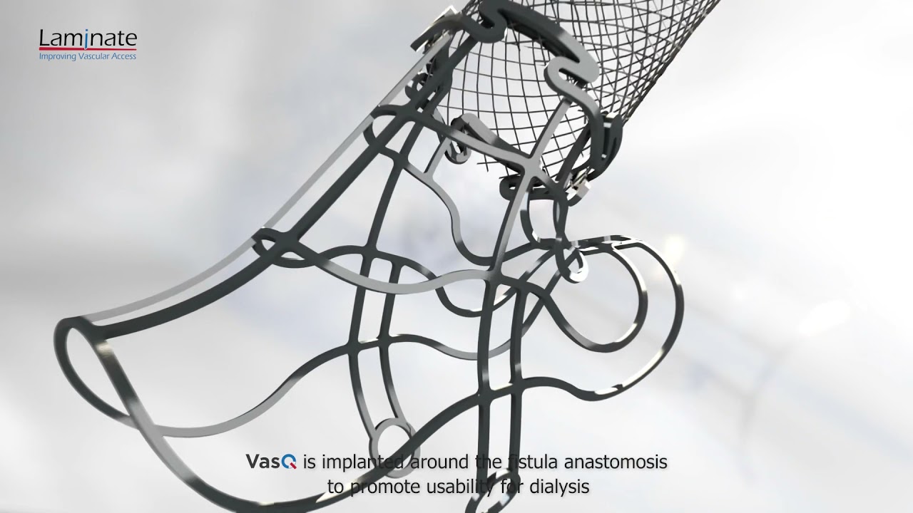 Laminate Medical Technologies - VasQ Device