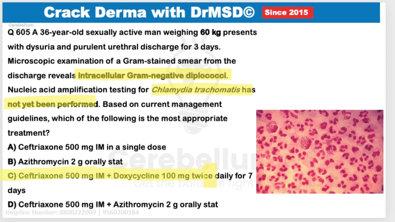 Двойная терапия при уретрите? #crackdermawithdrmsd 605
